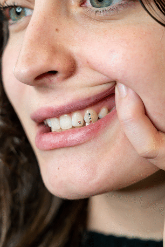 Gemme dentali Milano